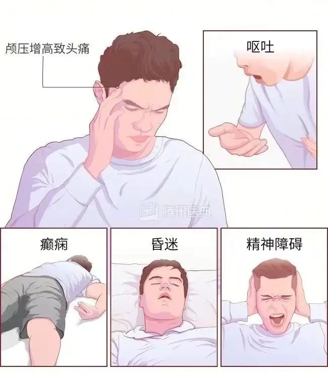 202403141448278508.Jpeg